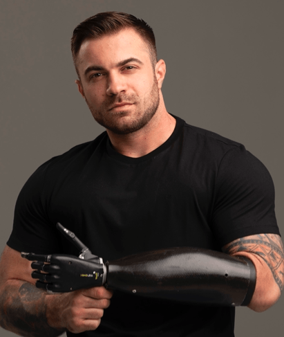Man with a prosthetic arm, wearing a black shirt, looking at the camera.