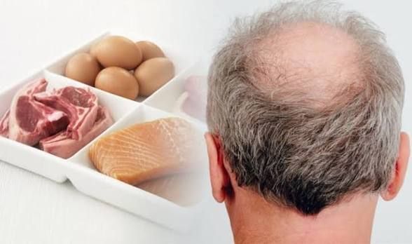 Protein rich foods for supporting normal hair growth and reducing hair shedding linked to low protein intake