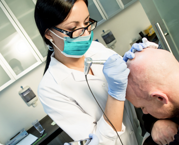 Scalp micropigmentation hairline and density result