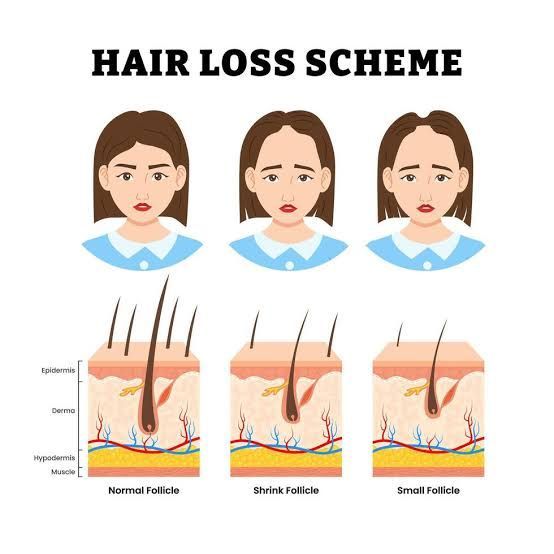 Hair loss and thinning guide