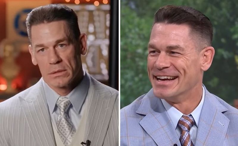 John Cena before and after hair transplant comparison
