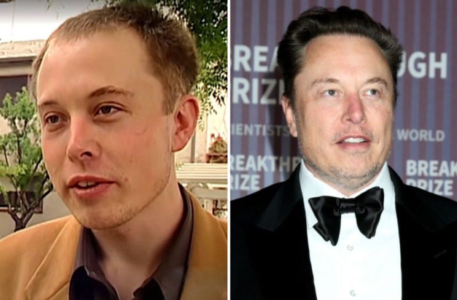 Elon Musk hairline comparison over time