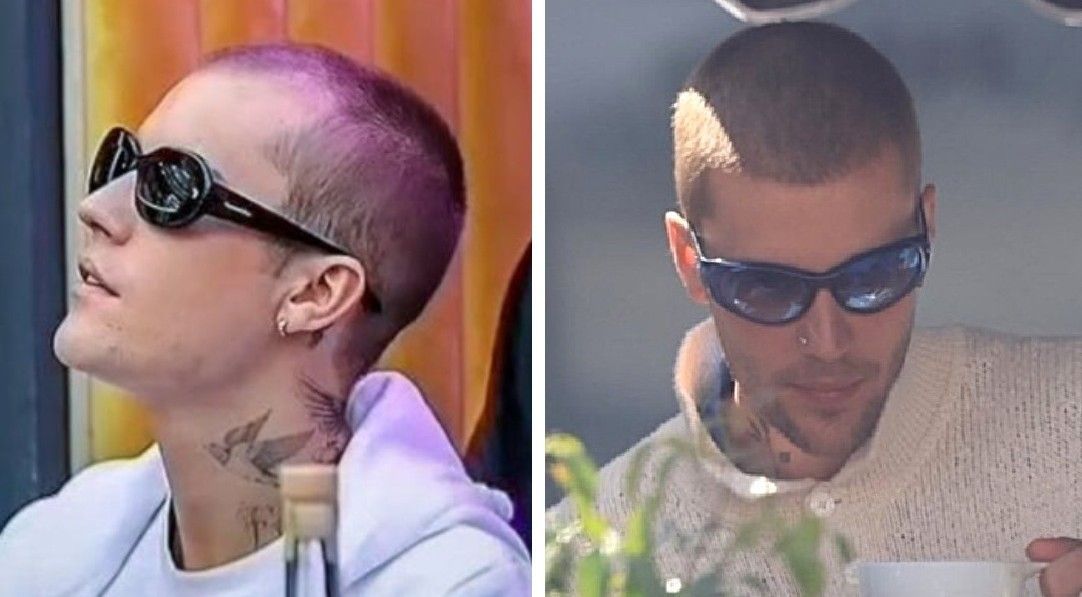 Justin Bieber hairline comparison over time