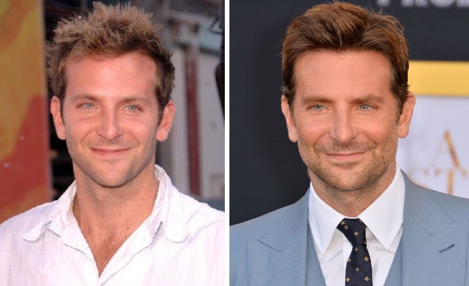 Bradley Cooper hairline and hair density comparison over time