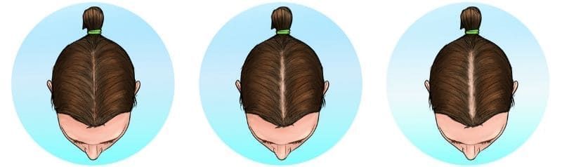 Three top-down views of a brown-haired head with a small bun on a light blue background