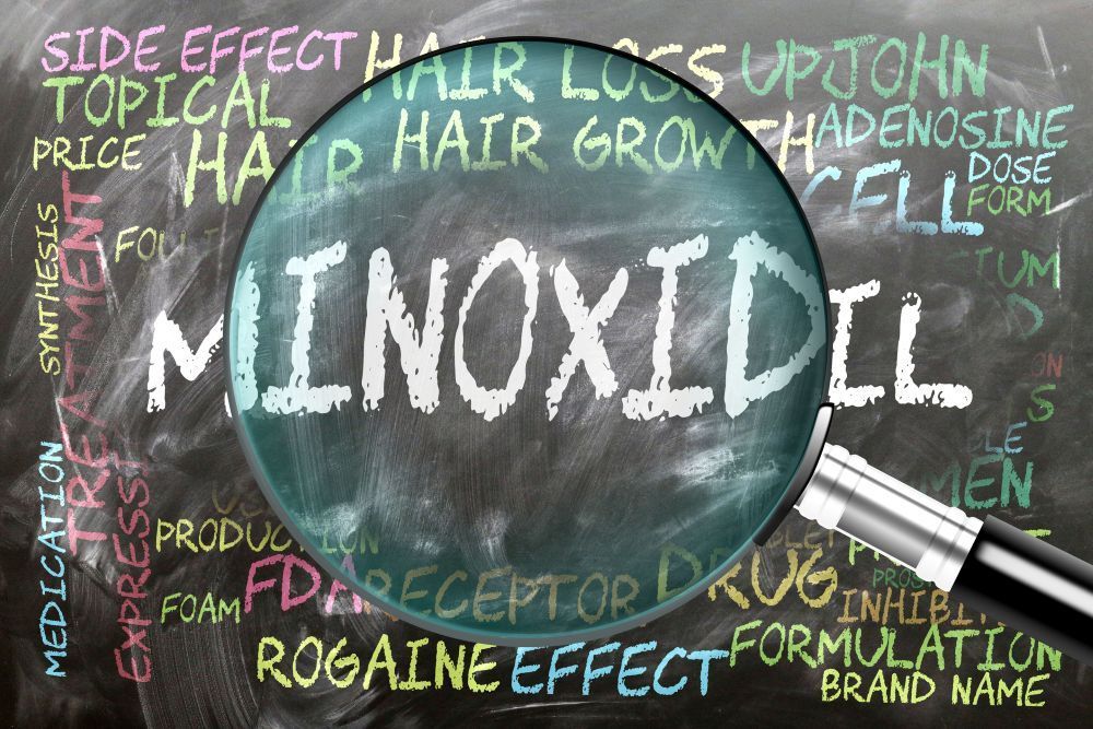 Minoxidil hair-loss treatment illustration