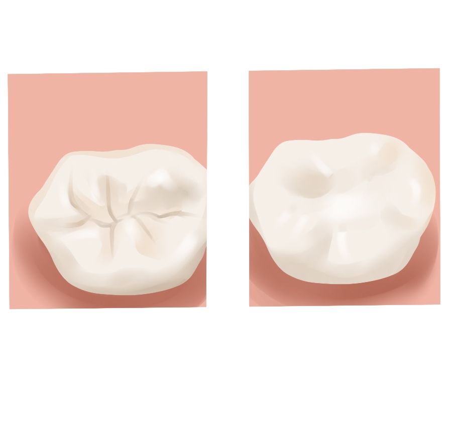 Two dental crown illustrations on pink backgrounds, showing one damaged and one smooth white crown
