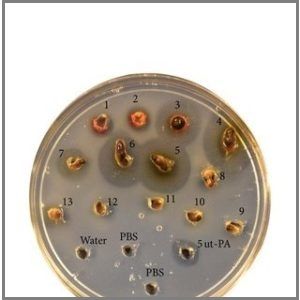 Earthworm as a biopharmaceutical: from traditional to precise