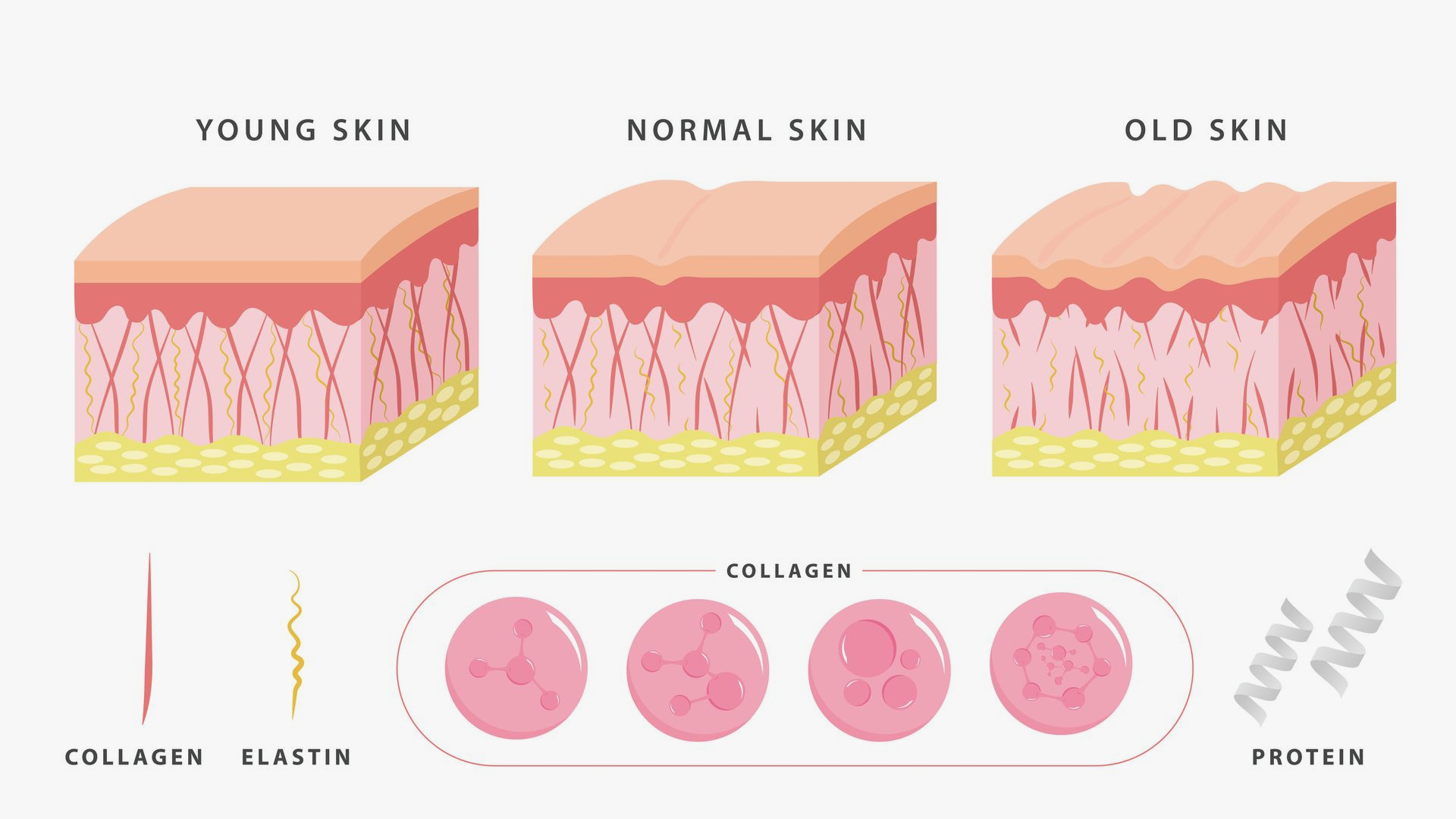 Diagram comparing young, normal, and old skin with collagen, elastin, and protein layers.
