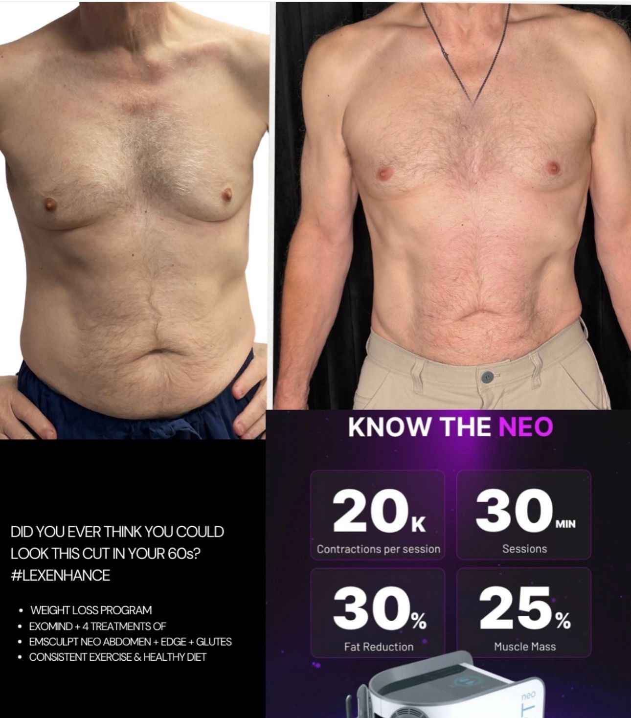 Side-by-side torso before-and-after fitness photos with a text panel showing transformation stats.