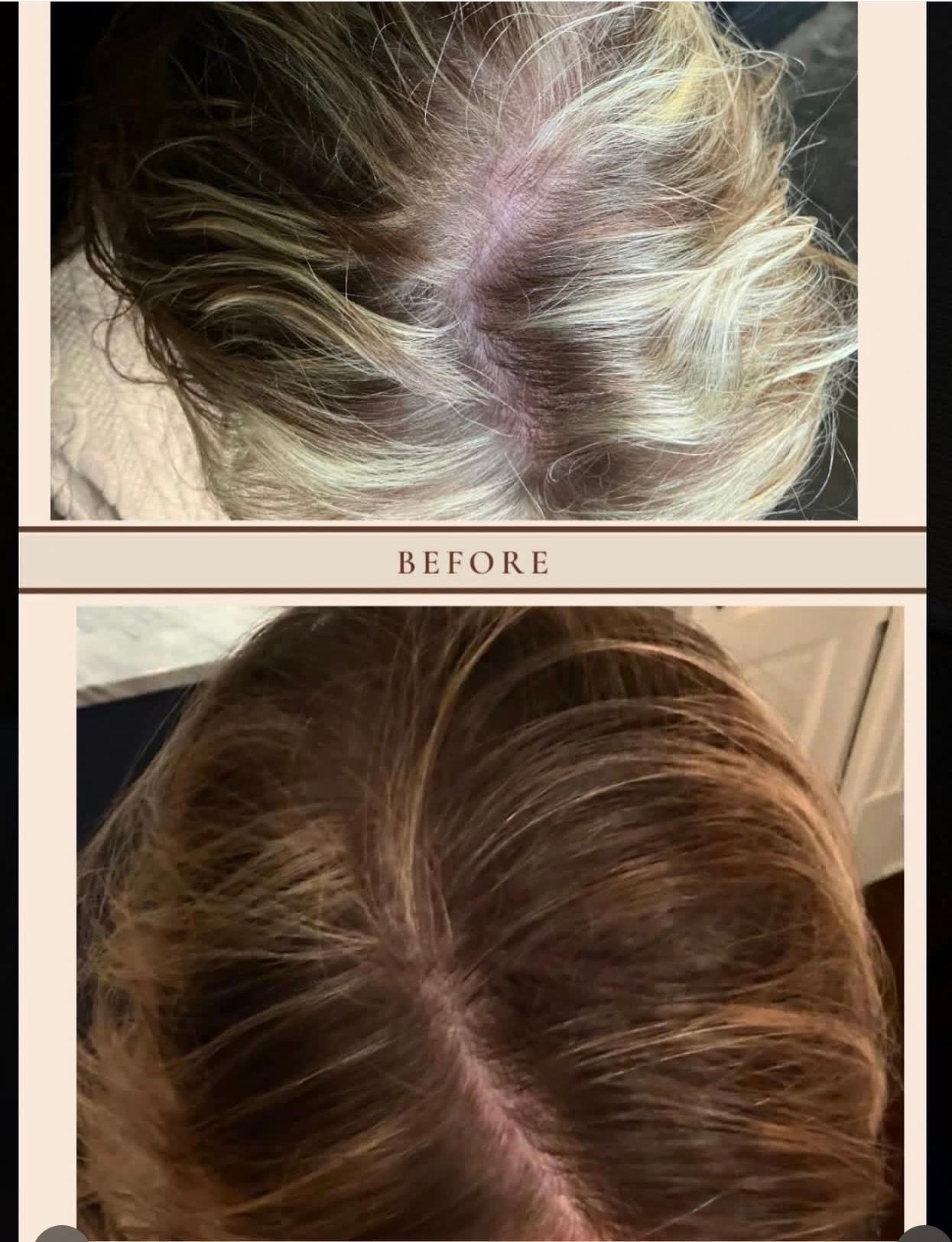Split view of scalp before and after, showing thinner and fuller hair coverage.