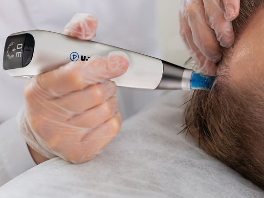 Medical device being applied to a person's head near the temple, with gloved hands in a clinical setting