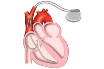 DR. GUILLERMO GONZÁLEZ RAMÍREZ - especialista en cardiología