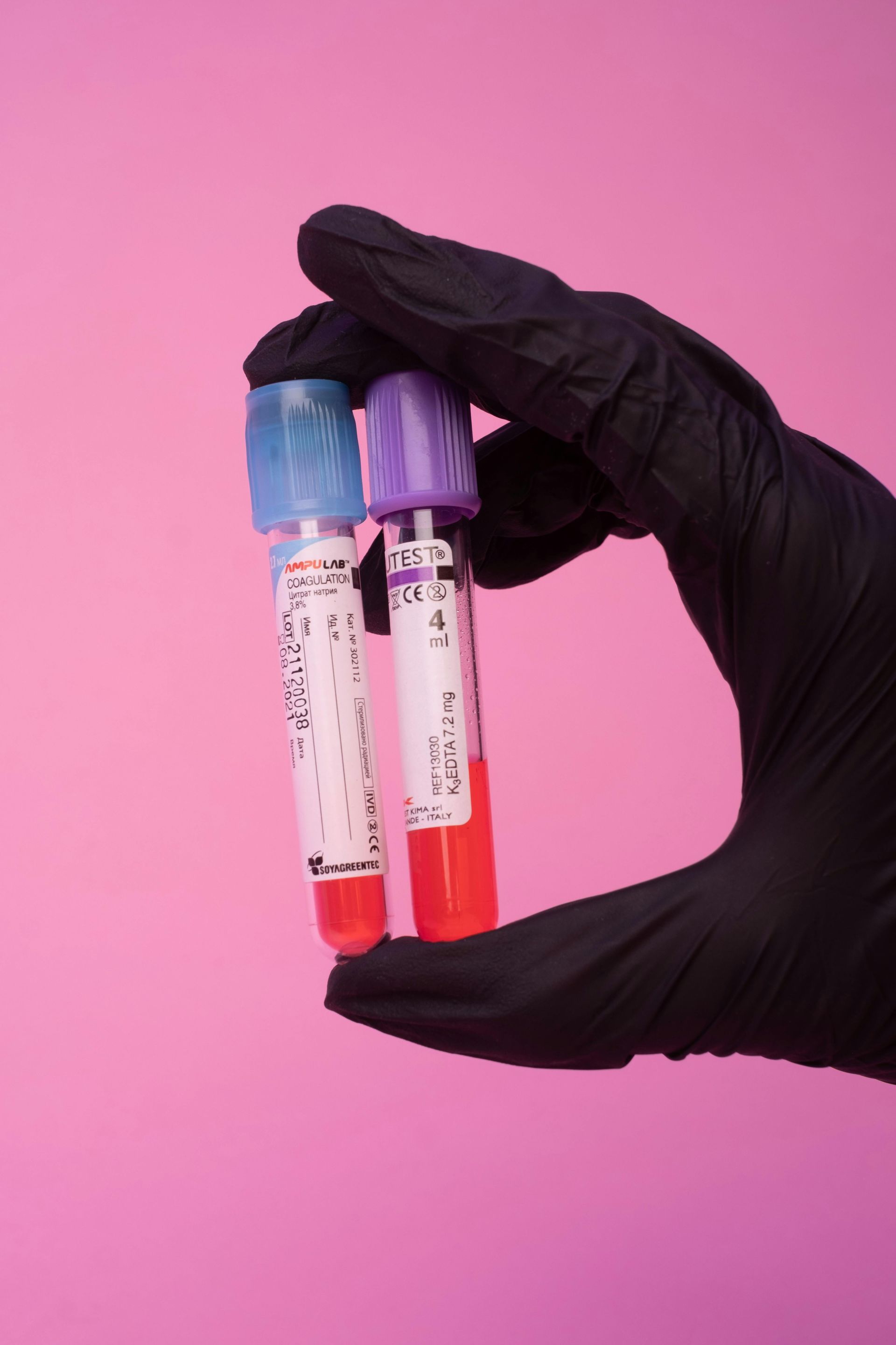 PRP Injection Therapy in Phoenix, Arizona.