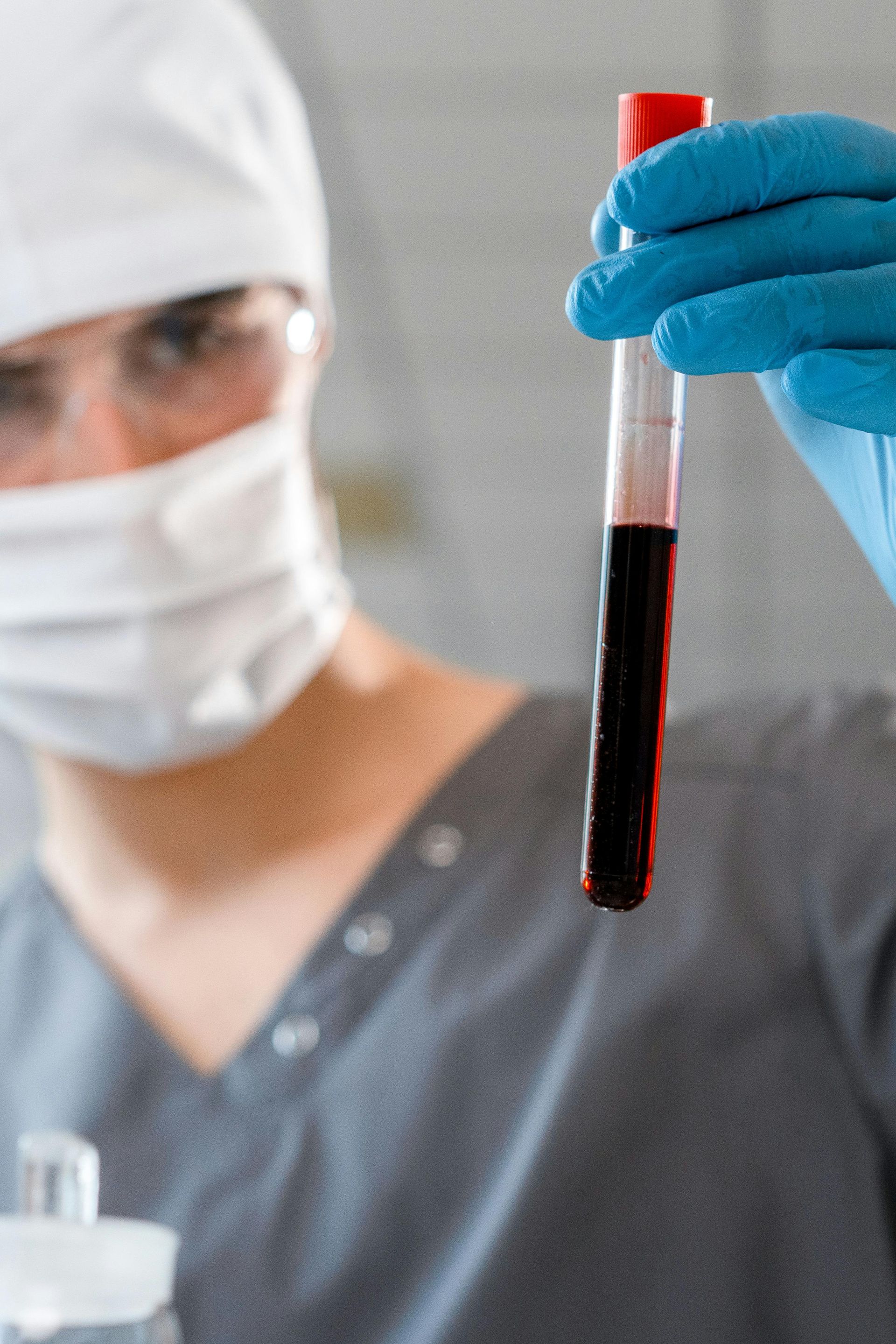 a vile of plasma used for PRP injections in Phoenix, AZ.