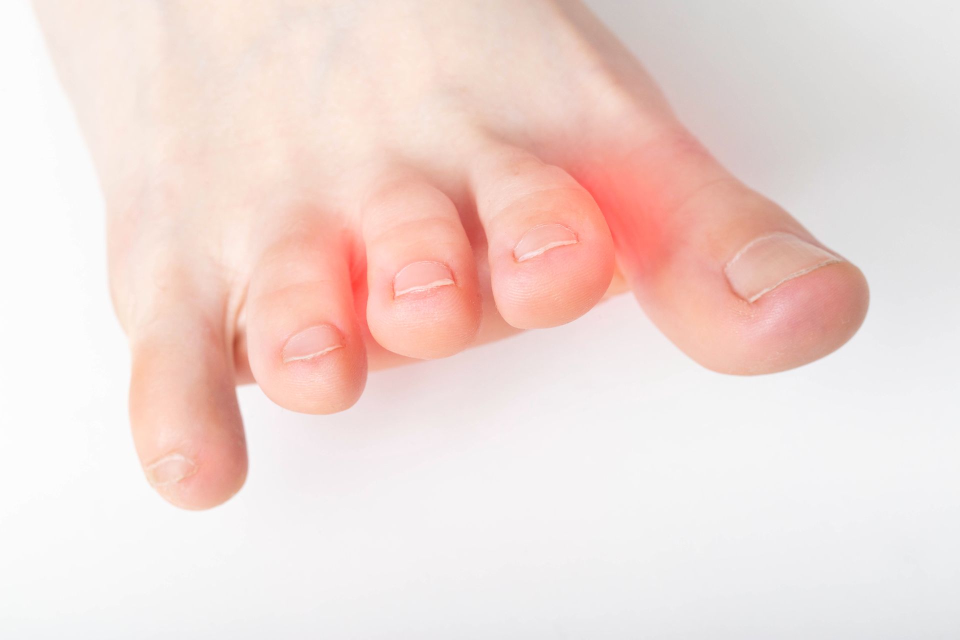 Foot with red highlighting around the third and fourth toes, indicating pain or inflammation.