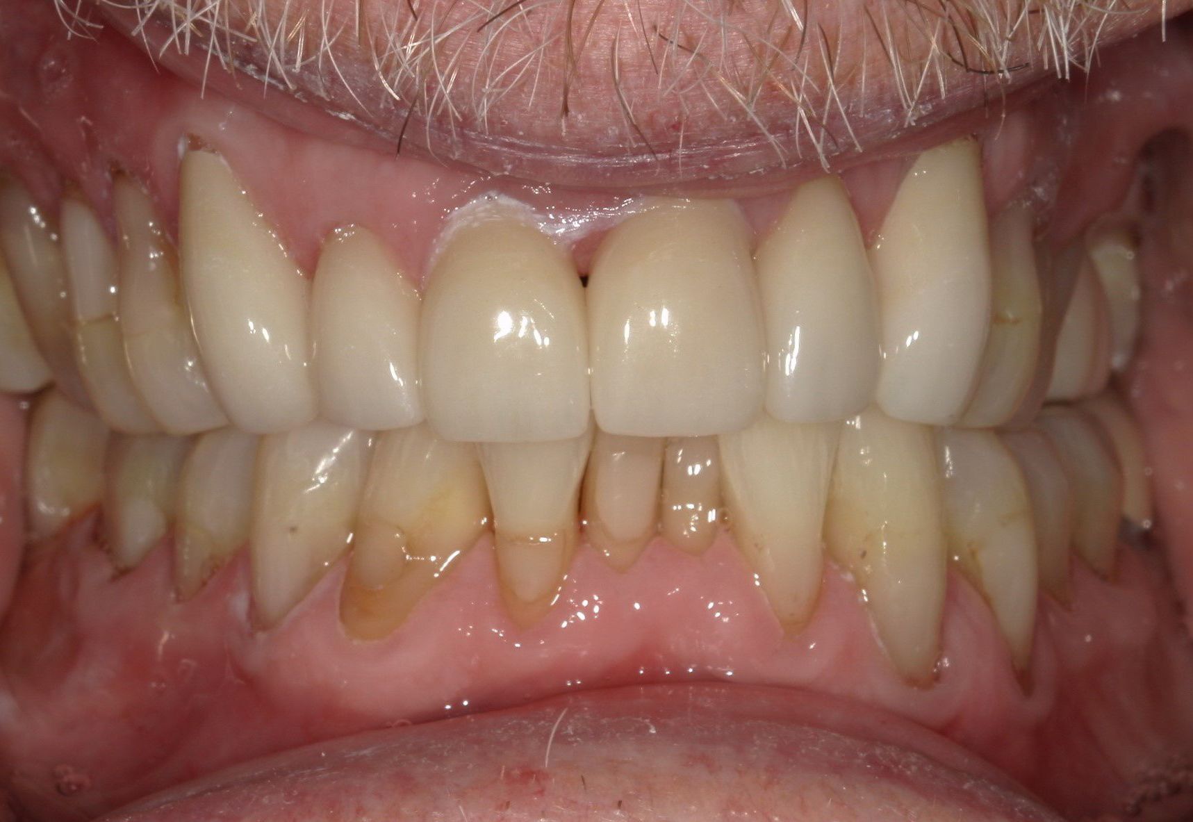 A close up of a man 's teeth with a beard.