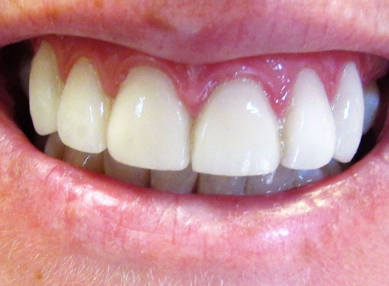 A close up of a person 's mouth with white teeth.