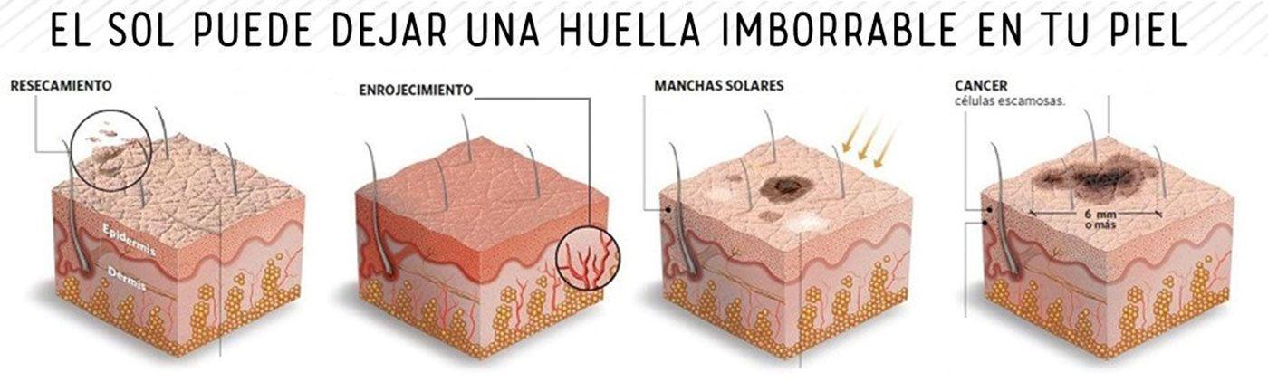 DR FCO JAVIER ROJAS ACOSTA - Diferentes tipos de manchas