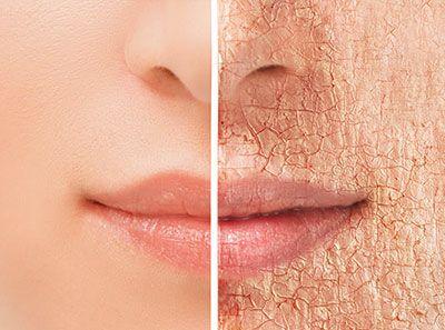 DR FCO JAVIER ROJAS ACOSTA - Cáncer en la piel  