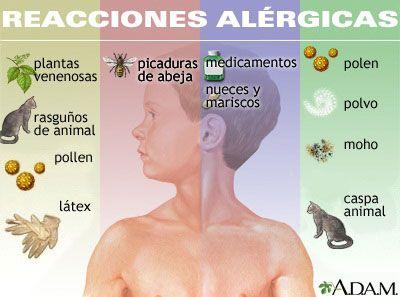 DR FCO JAVIER ROJAS ACOSTA - Alergias   