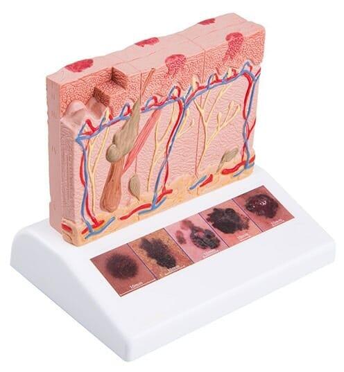 DR FCO JAVIER ROJAS ACOSTA - Mezquinos daño solar