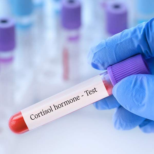 A gloved hand holding a blood sample tube labeled “Cortisol hormone Test.”