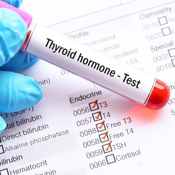 Gloved hand holding a “Thyroid hormone - Test” tube over a lab results form