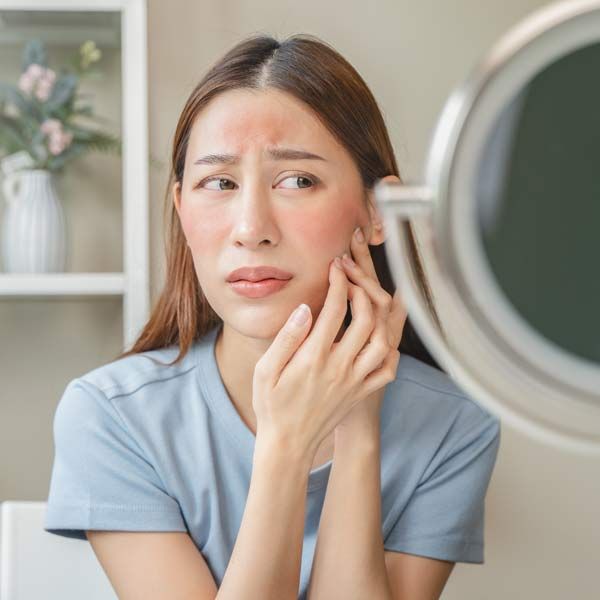 Woman with PCOS in a blue shirt touching her cheek, looking concerned about her acne