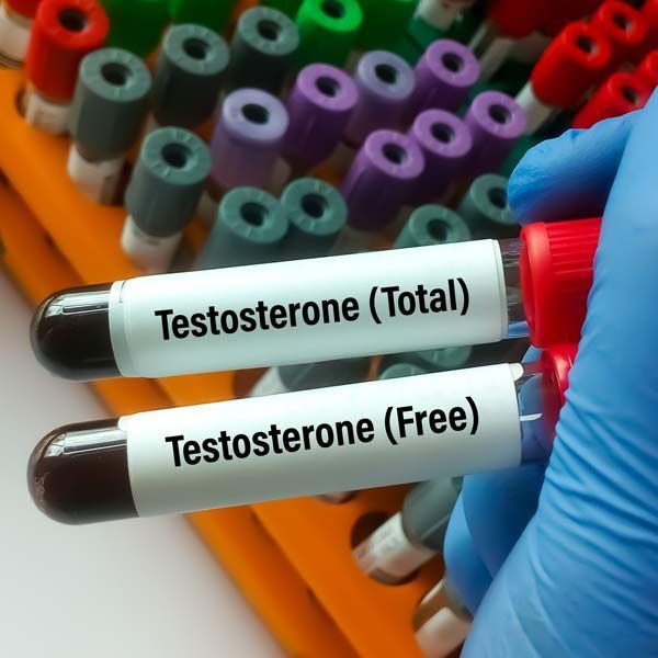 A hand is holding two test tubes labeled testosterone ( total ) and testosterone ( free ) testing for Testosterone Replacement Therapy