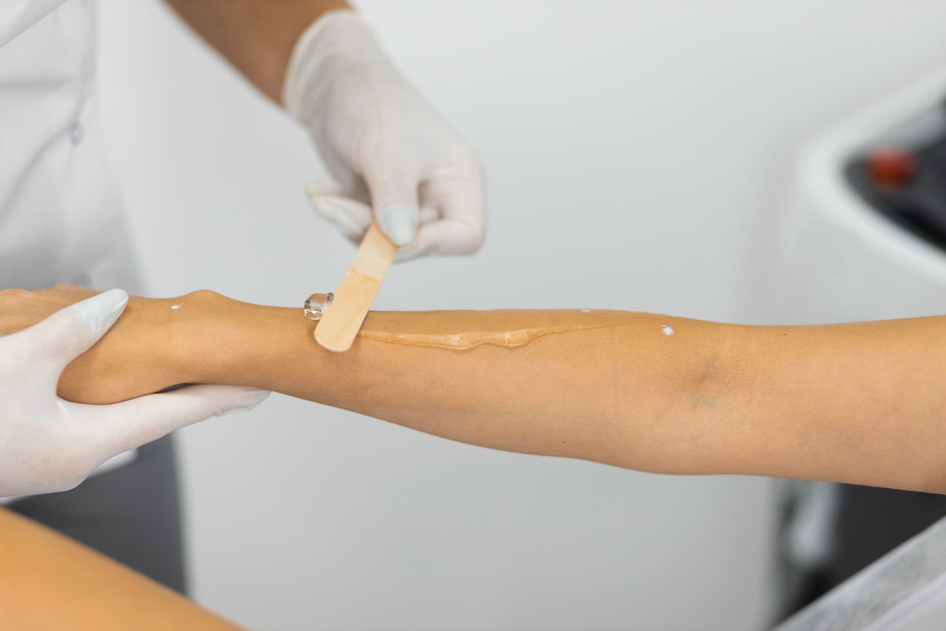A woman is getting her arm waxed by a doctor.