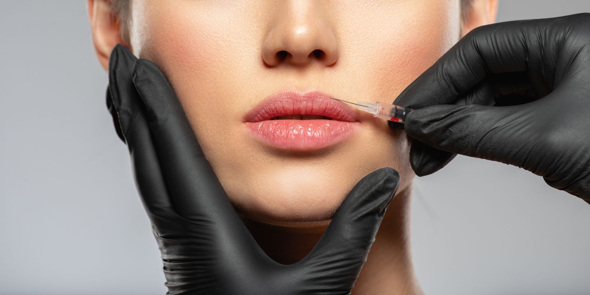 Close-up of a person's lips during a cosmetic procedure, gloved hands hold a needle with a thread.