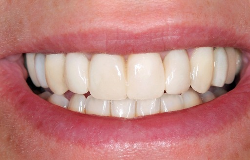 Close-up of a smiling mouth showing straight white teeth and pink lips