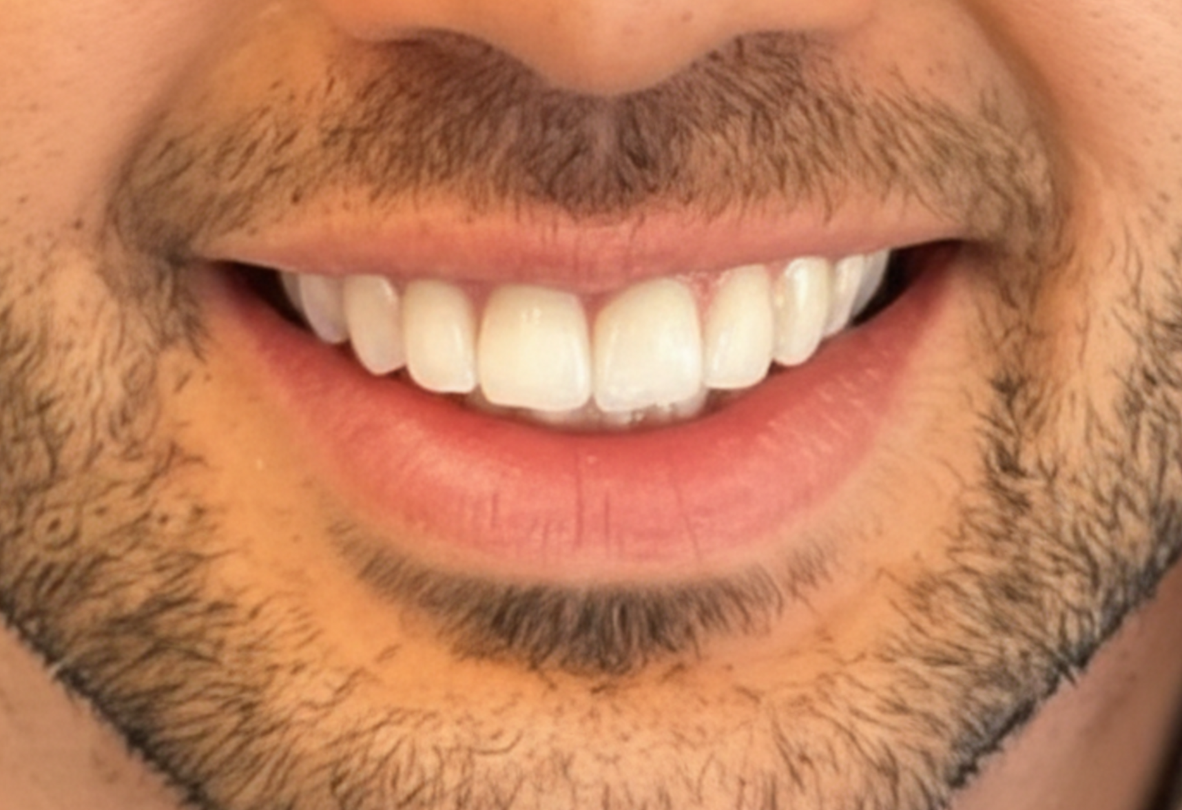 A close up of a man 's mouth with a beard and white teeth.