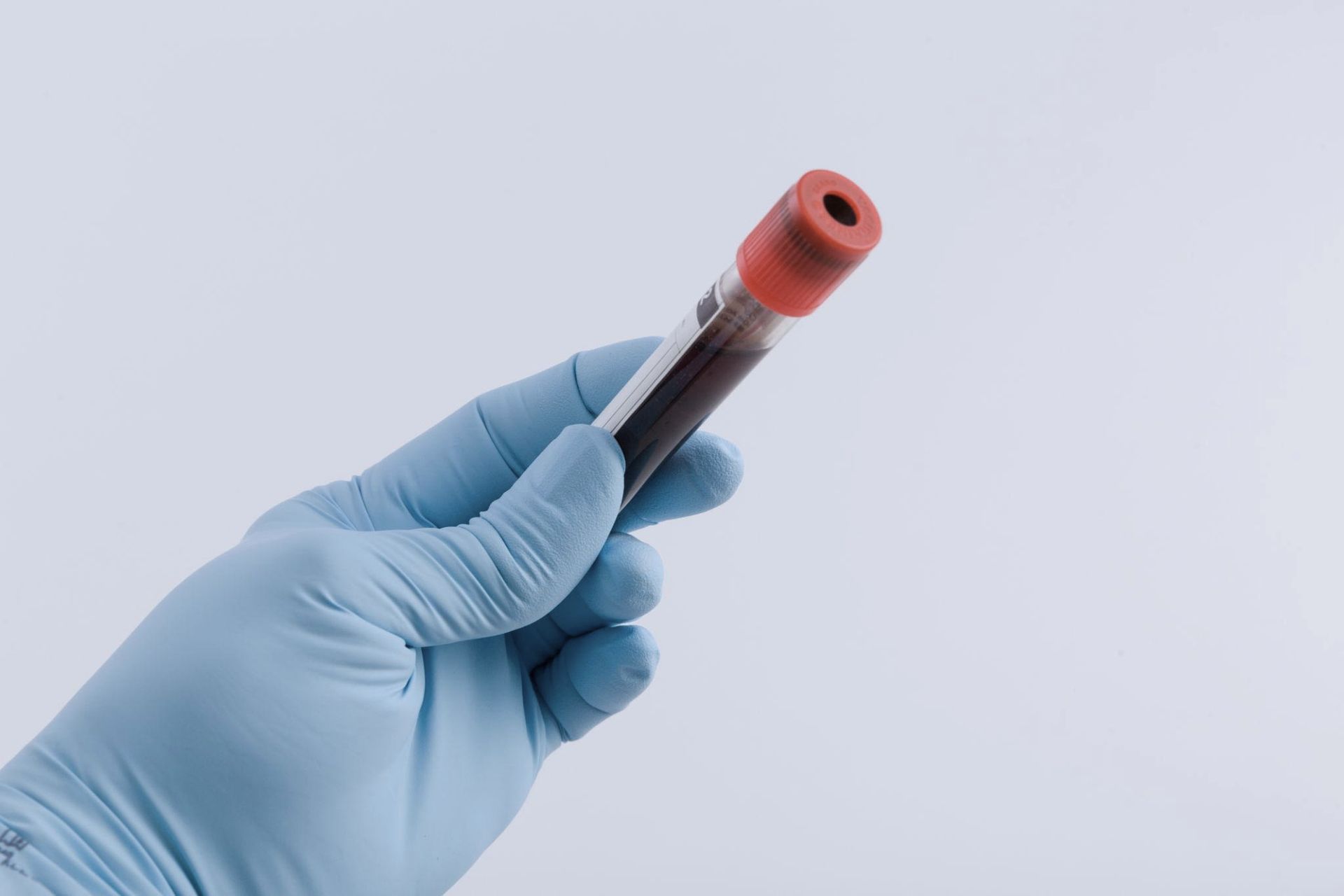 Blood sample used for in-house lab testing at Elle Medical & Aesthetics in Lafayette, Louisiana
for hormone and wellness evaluation.