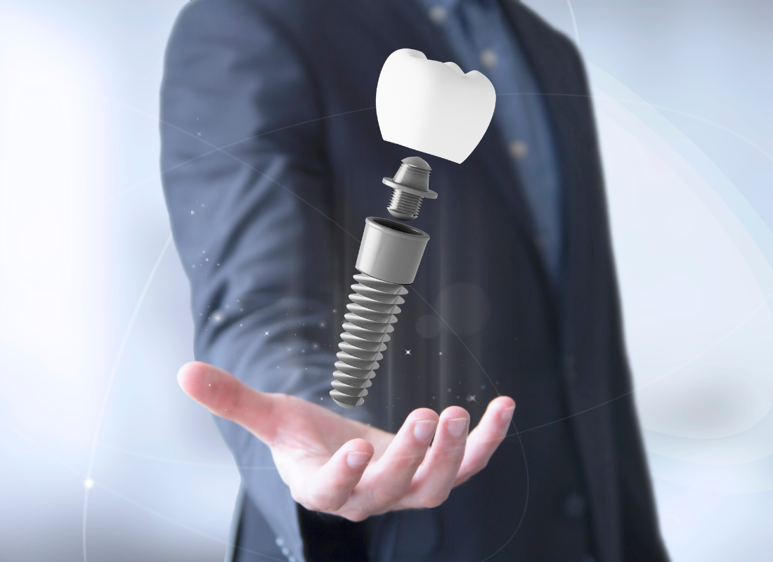 Man holding virtual dental implant | Best cosmetic dentist in Corpus Christi 78404