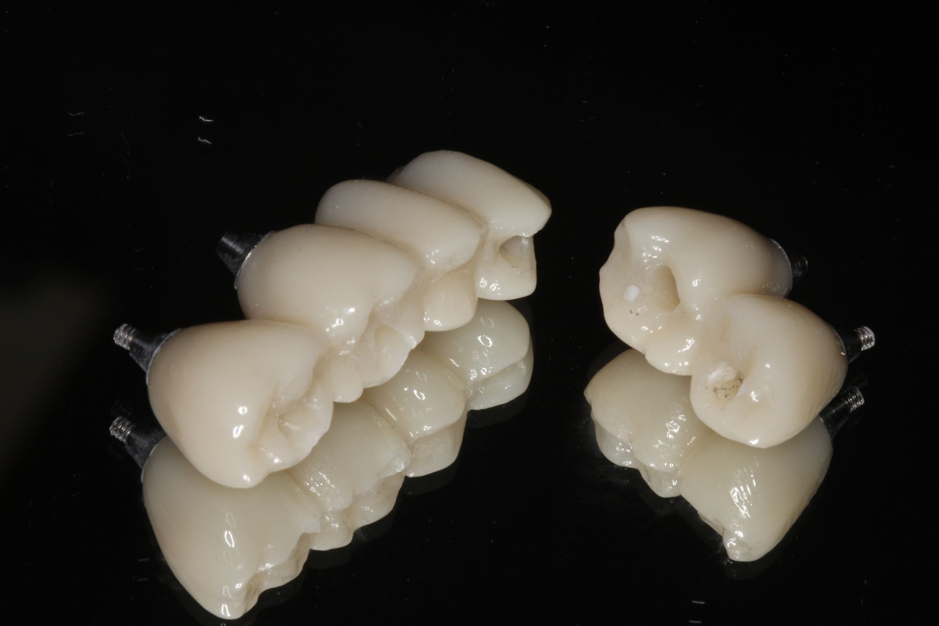 Dental crowns and bridges