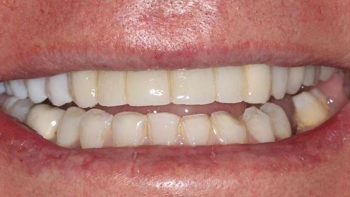 Before smile makeover