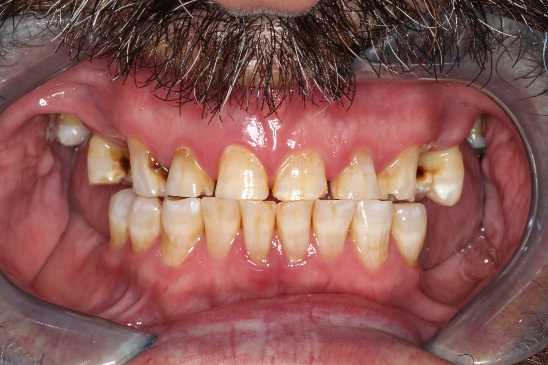 Before smile makeover