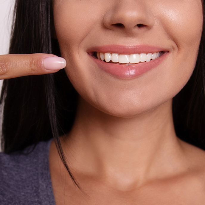 woman smiling after gum disease therapy | gingivectomy from top periodontist in Corpus Christi 78404