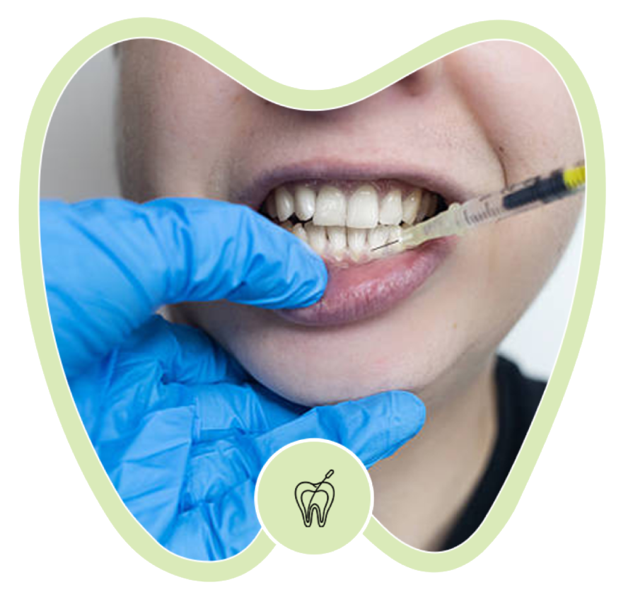 A gloved hand holds a syringe to administer an injection into a person's gum line near their lower teeth.