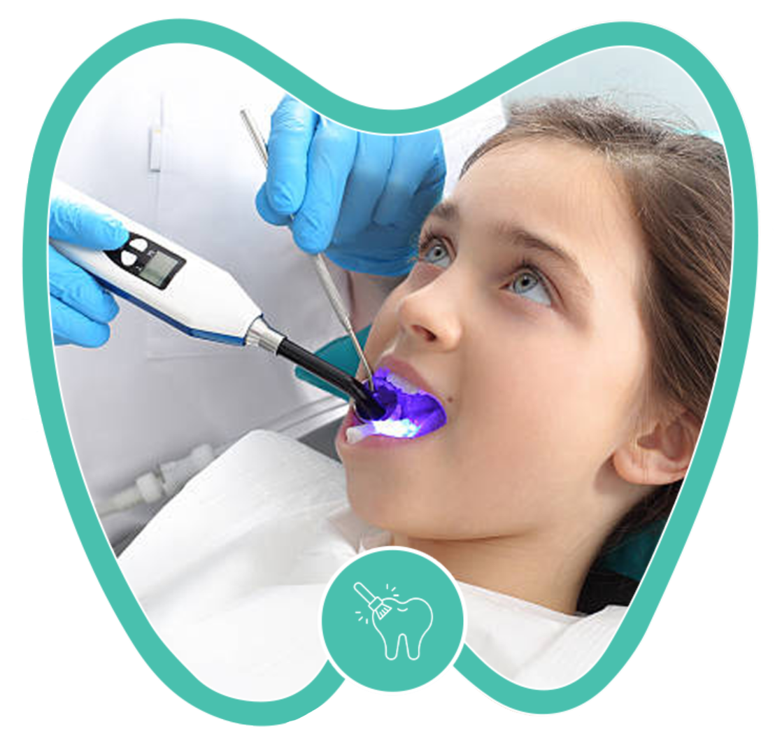 A dentist uses a blue light curing tool on a patient's teeth during a dental procedure.
