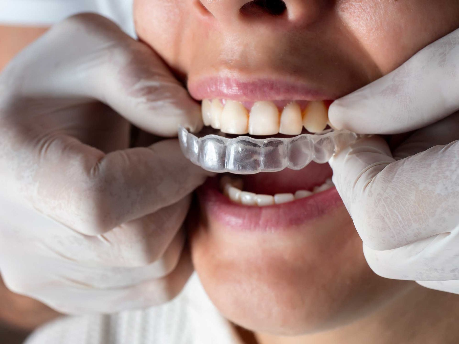 Woman at dentist's office wearing invisible aligners, receiving expert orthodontic care.