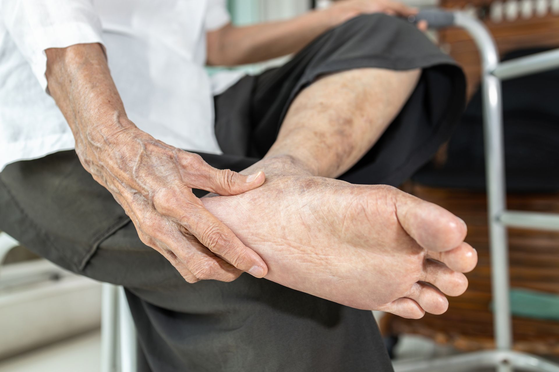 Person seated, touching foot. Shows wrinkles, skin discoloration; indoors with chair.
