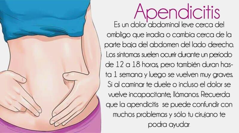 DR. SERGIO U. ACOLTZI ESCORCIA - APENDICITIS