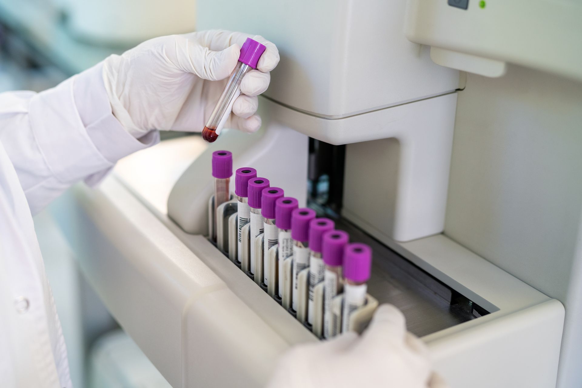 Close-up of a doctor hand looking at blood sample test tube in a machine. 