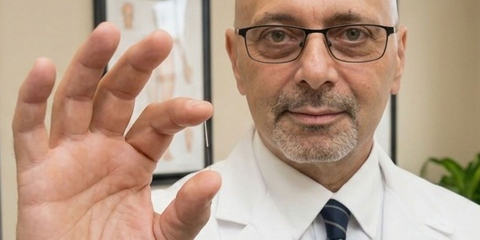 NYC Acupuncturist showing a close-up of needles for Micro Acupuncture NYC and Acunova by Marc Bystock, L.Ac.