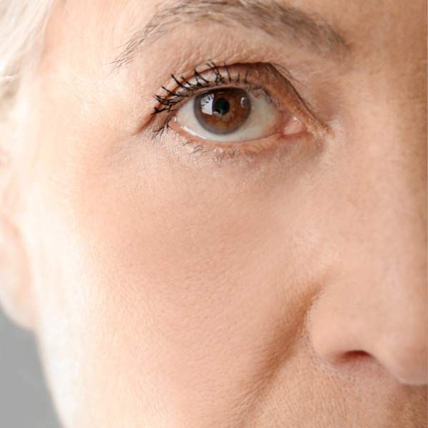 Close-up of a person's eye and face with brown eye, wrinkles, and subtle smile. Representing Acu Lift Technique