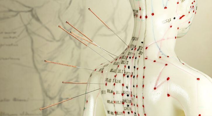 Doll showing the location of Acupuncture Treatments NYC by Marc Bystock L.Ac.