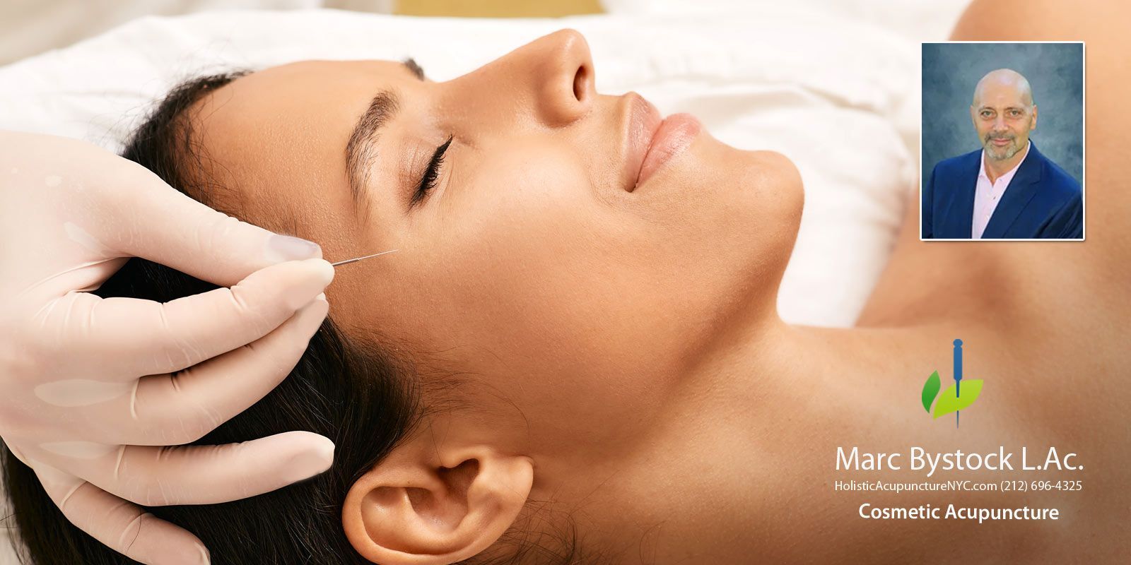 A Woman having a cosmetic Acupuncture Procedure